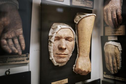 Foto mit Exponaten der Pathologisch-Anatomischen Sammlung im Narrenturm: verschiedene Hände und ein Gesicht mit Hautkrankheiten
