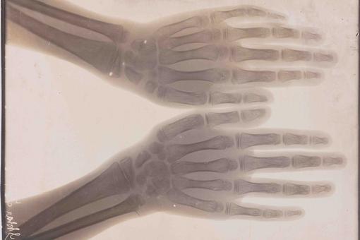 Aufnahme eines Röntgenbildes von zwei Händen