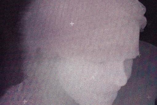 Fotografie von Simon Lehner. Zu sehen ist der Kopf eines Menschen, grob gepixelt in den Farben Hellrosa bis Dunkelrosa vor schwarzem Hintergrund